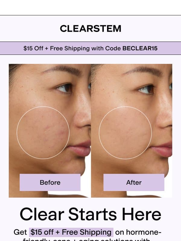 Transformations That Inspire You 🌟 email from Clearstem Skincare