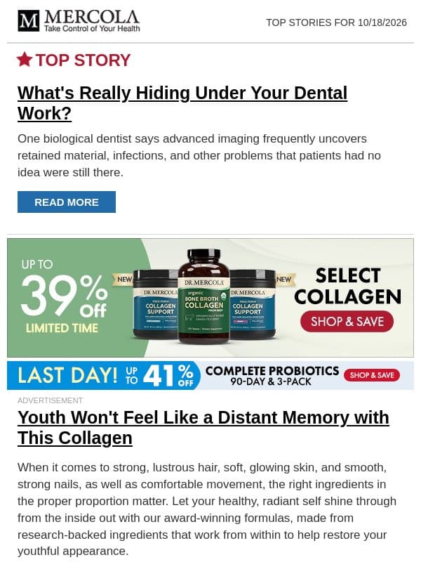 What's Really Hiding Under Your Dental Work? email from Mercola