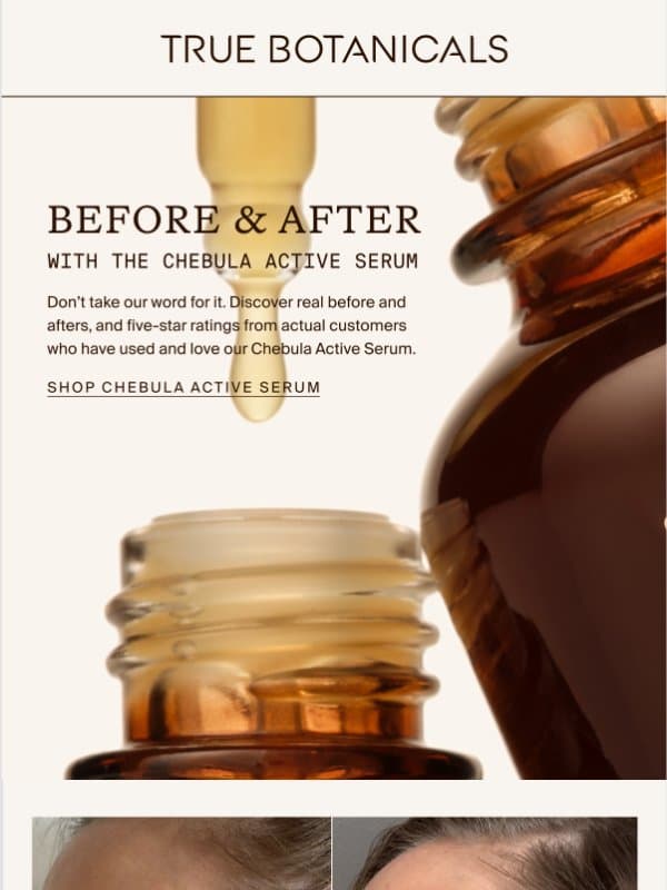 Before and afters from our community. email from True Botanicals